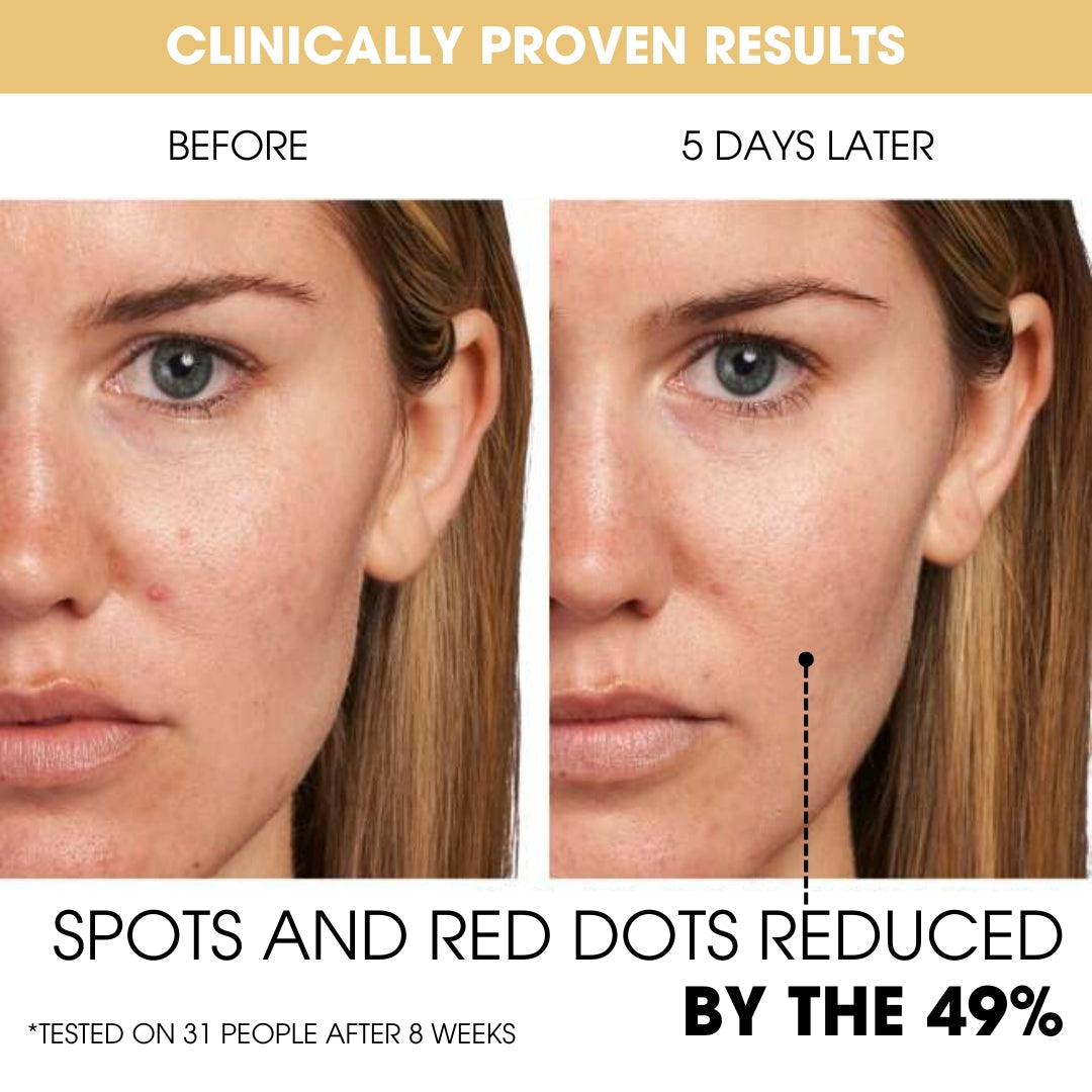 Oracluxe Gel with Vitamin C Capsules