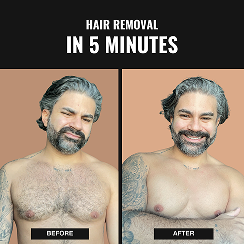 Oracluxe No-Shave Hair Removal Spray - Sale