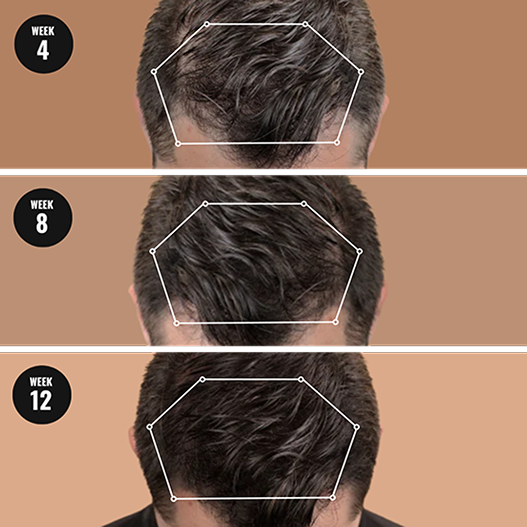 Oracluxe Root Activator Shampoo