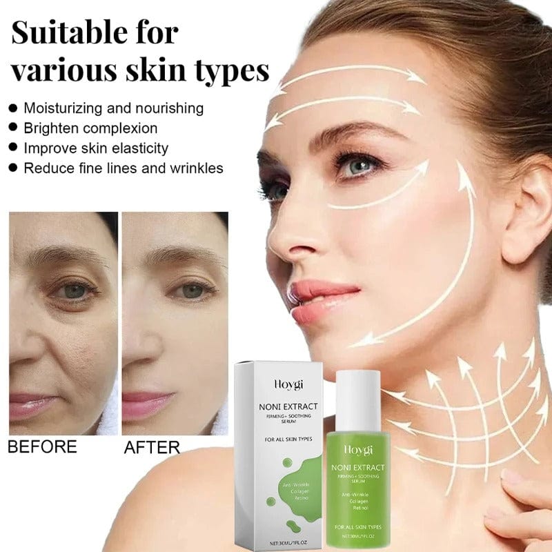 Oracluxe Noni Fruit Serum – Anti-Aging Skin Care - oracluxe