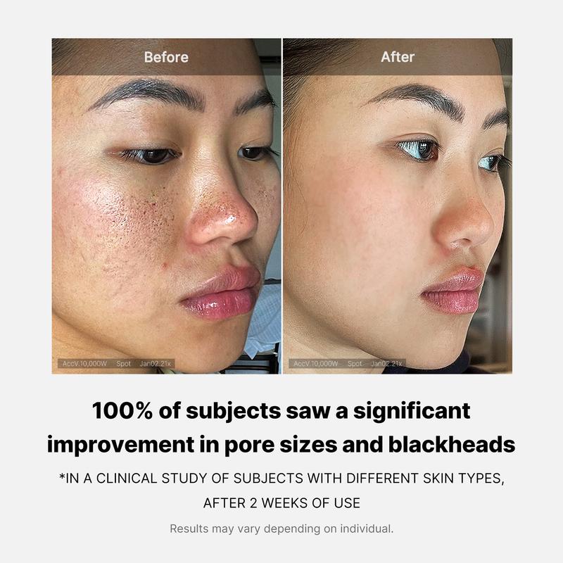Oracluxe zero pore pads