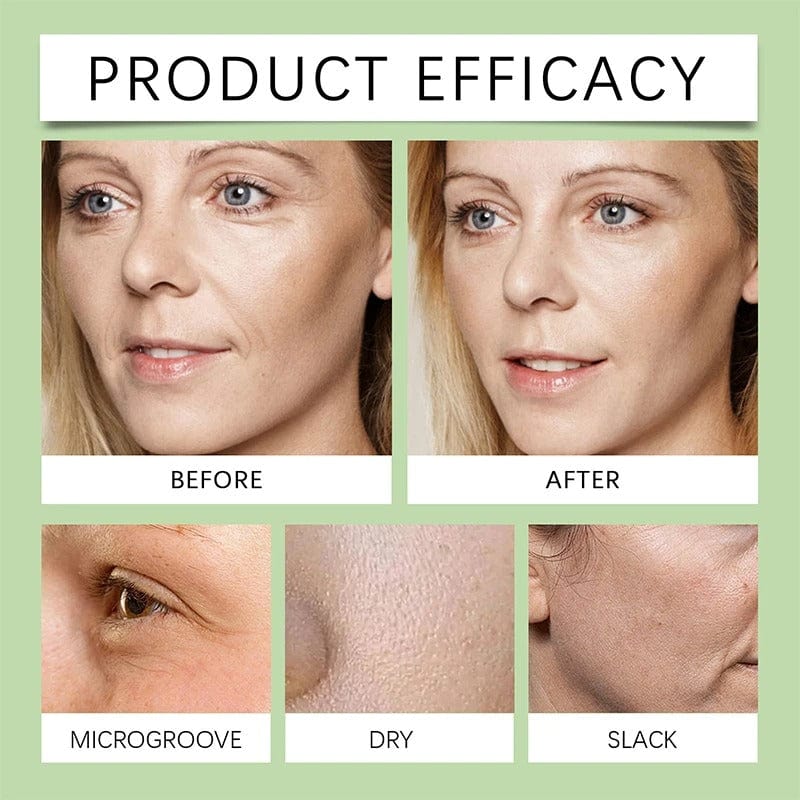 Oracluxe Noni Fruit Serum – Anti-Aging Skin Care - oracluxe