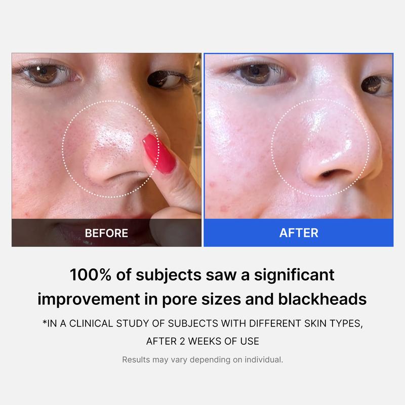 Oracluxe zero pore pads