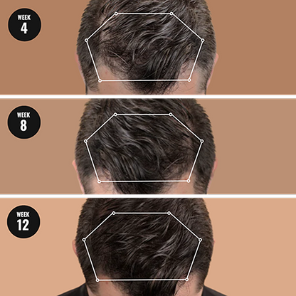 Oracluxe Root Activator Shampoo