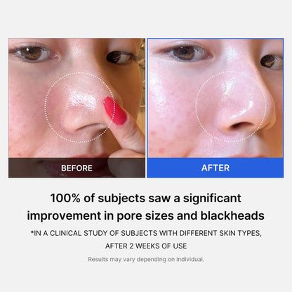 Oracluxe  zero pore pads